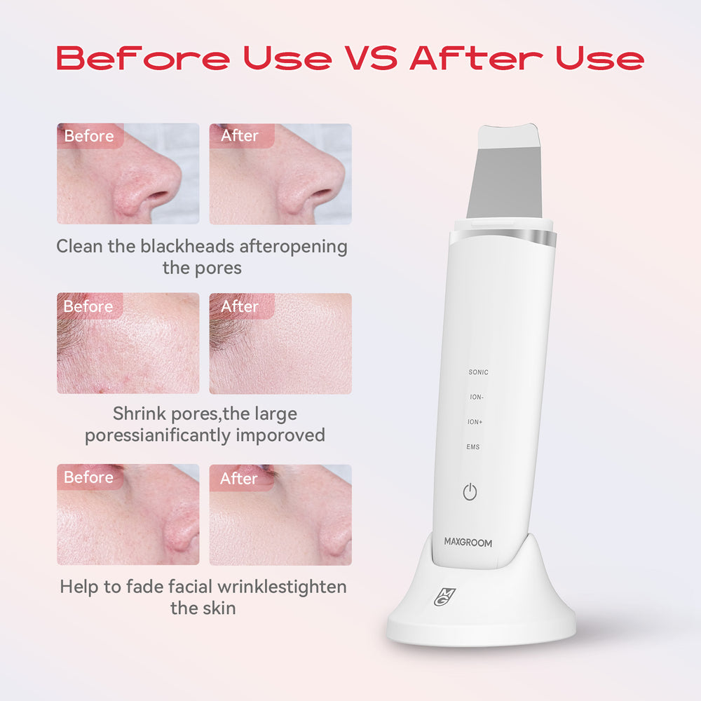 MAXGROOM M-169 ultrasonic cavitation peeling device with LED light therapy - white_8