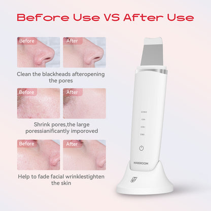 MAXGROOM M-169 ultrasonic cavitation peeling device with LED light therapy - white_8